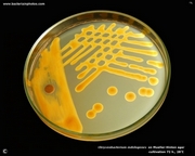 mueller hinton agar and chryseobacterium indologenes